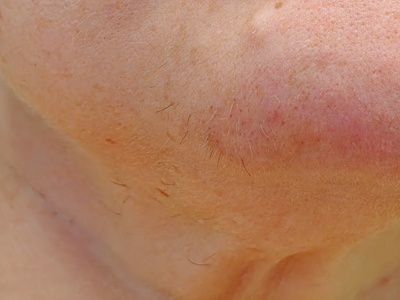 Woman covering chin